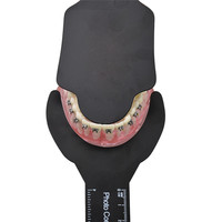 6 sztuk Dental ortodontyczne czarne tło zdjęcie obrazu kontrast pokładzie ustnej policzek płyta ze skalą Mark autoklawowalne dentysta narzędzia 2